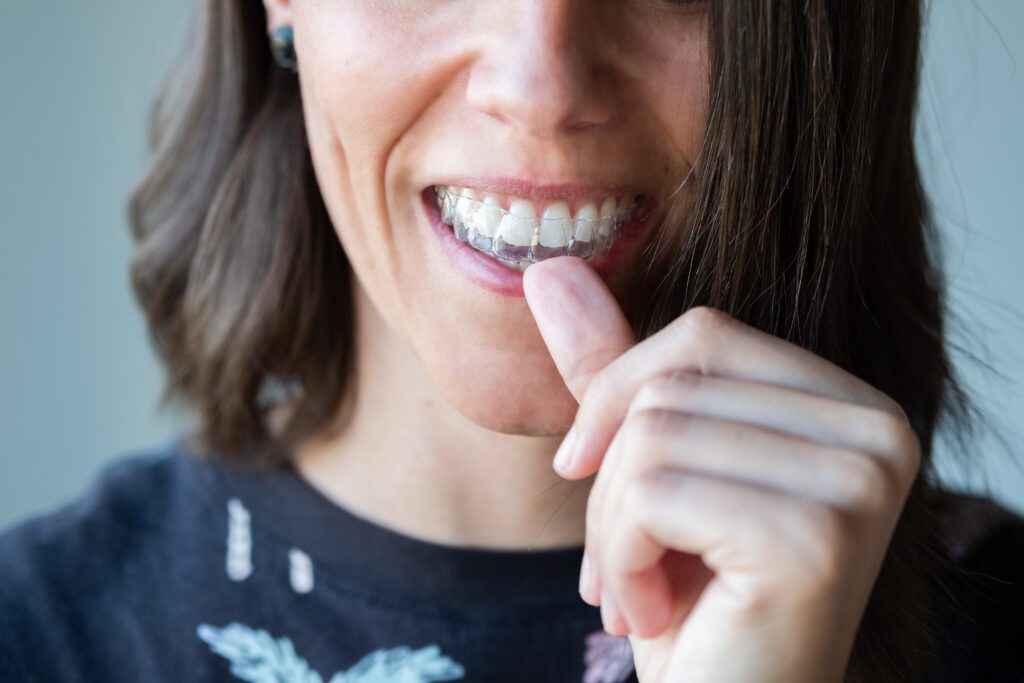 The Ultimate Guide: Answering the Most Common Questions About Invisalign - MyOrthodontist - NJ orthodontist NJ orthodontist